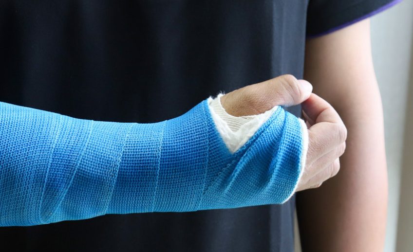 Closeup of Asian man's arm with long arm plaster, fiberglass cast therapy cover by blue elastic bandage after sport injury.