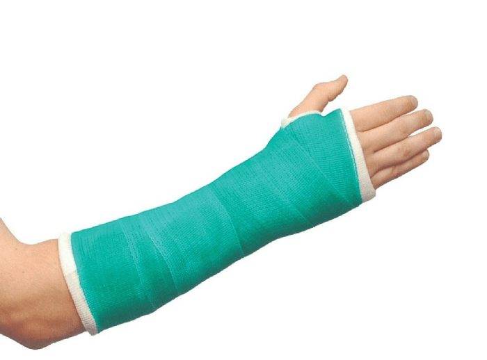 Waterproof Casts – Hand Therapy Centre – Newcastle & Maitland